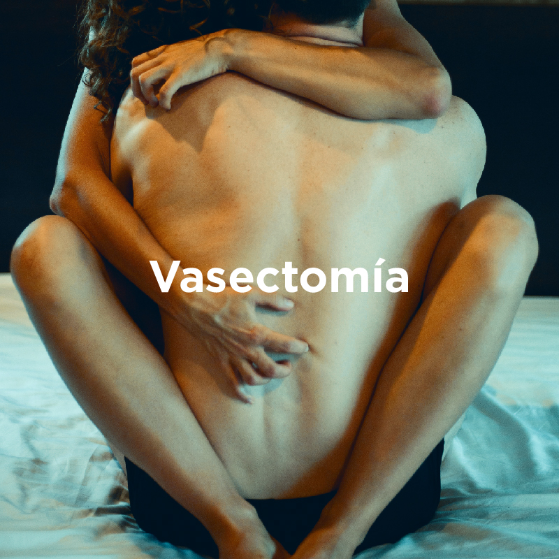 La vasectomía es un método de anticoncepción eficaz.